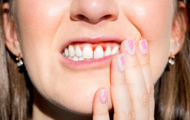 jak dbać o zęby